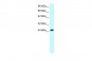 FLJ11730 antibody - N-terminal region